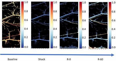 Resuscitation After Hemorrhagic Shock in the Microcirculation: Targeting Optimal Oxygen Delivery in the Design of Artificial Blood Substitutes